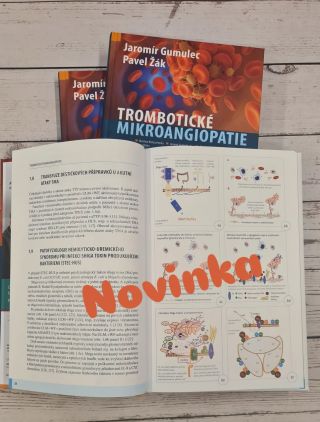 Trombotické mikroangiopatie jsou naše další novinka. Mrkněte na ukázku na e-shopu www.eshop.maxdorf.cz.📚 #knihy...